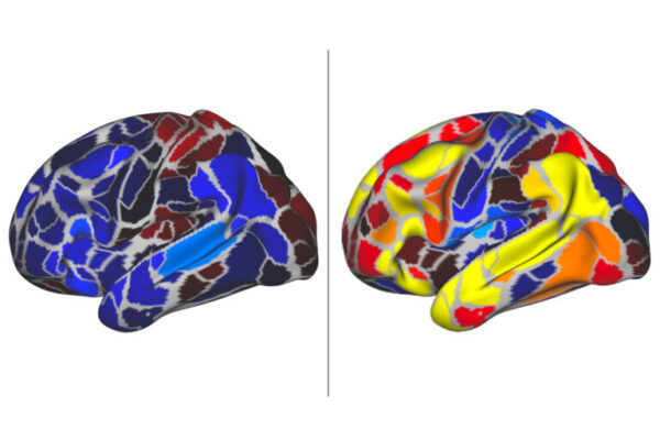 Brain activity varies with age in children with autistic traits