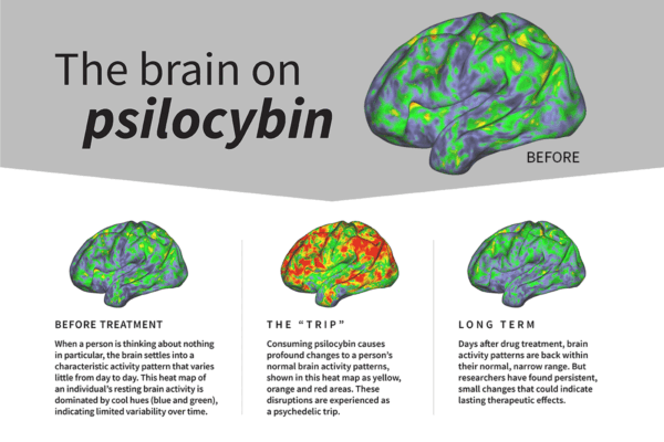 Psilocybin generates psychedelic experience by disrupting brain network